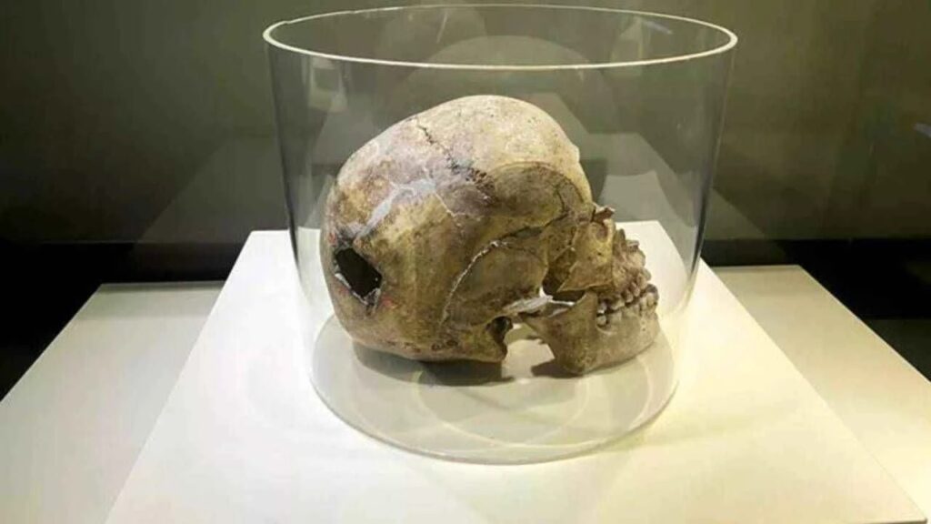 5 bin yıl önce ameliyat edilen kafatası ilgi çekiyor